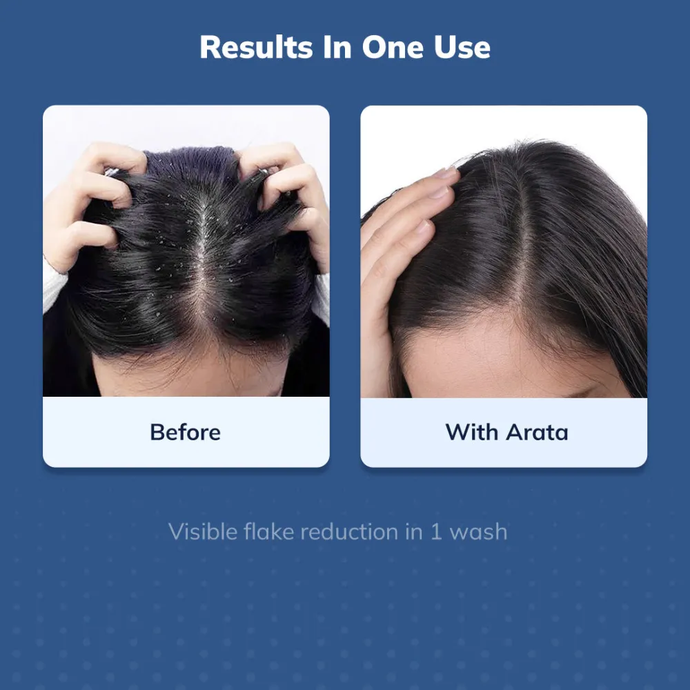 Arata Anti-Dandruff Serum (Tonic) for Women and Men | With Glycolic Acid & Piroctone Olamine | Up to 100% Dandruff Reduction | Reduces Flaking & Itching - 100ml - Image 3