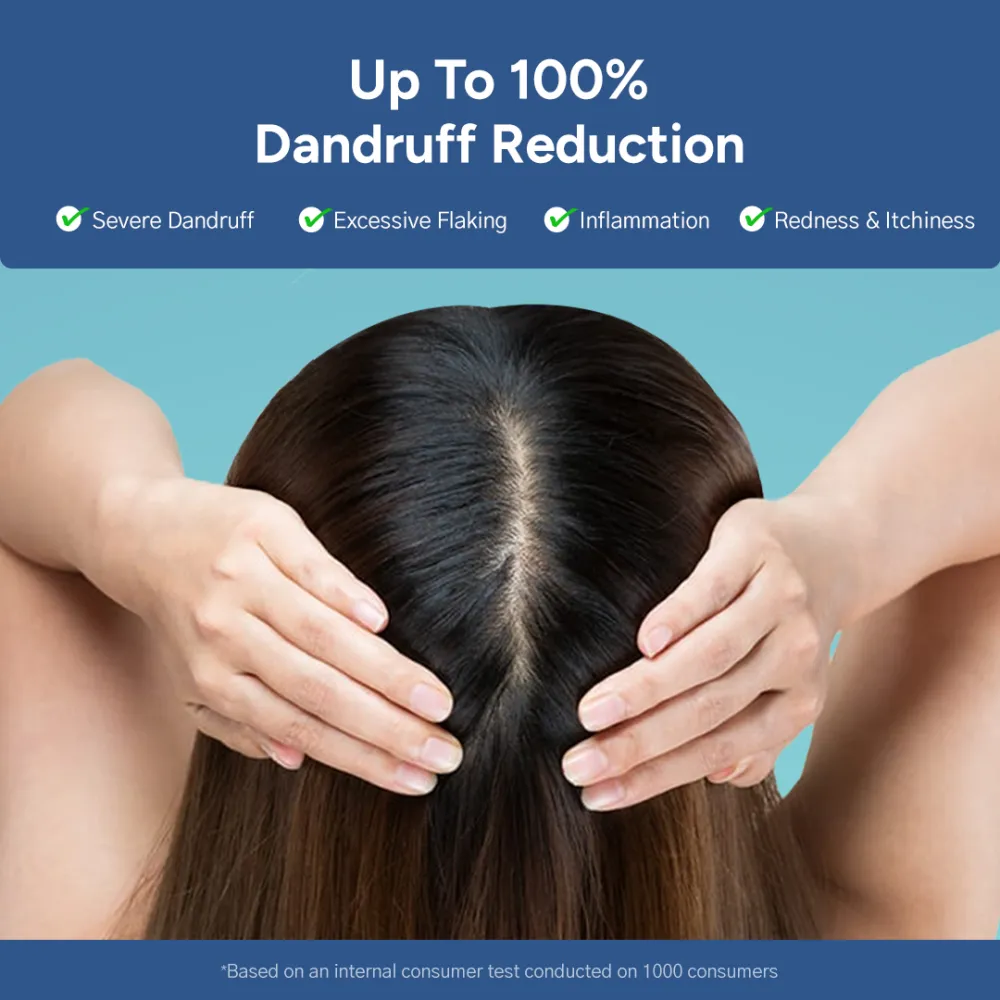 Arata Anti-Dandruff Shampoo, Tonic, Free Conditioner Combo | Piroctone Olamine & Glycolic Acid | Up To 100% Dandruff Reduction | Hydrates | 200+200+100ml - Image 5