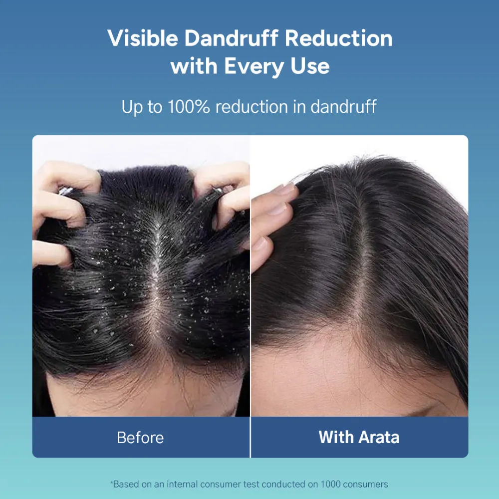 Anti-Dandruff Shampoo (Normal to Oily Hair) - 200ml - Image 3