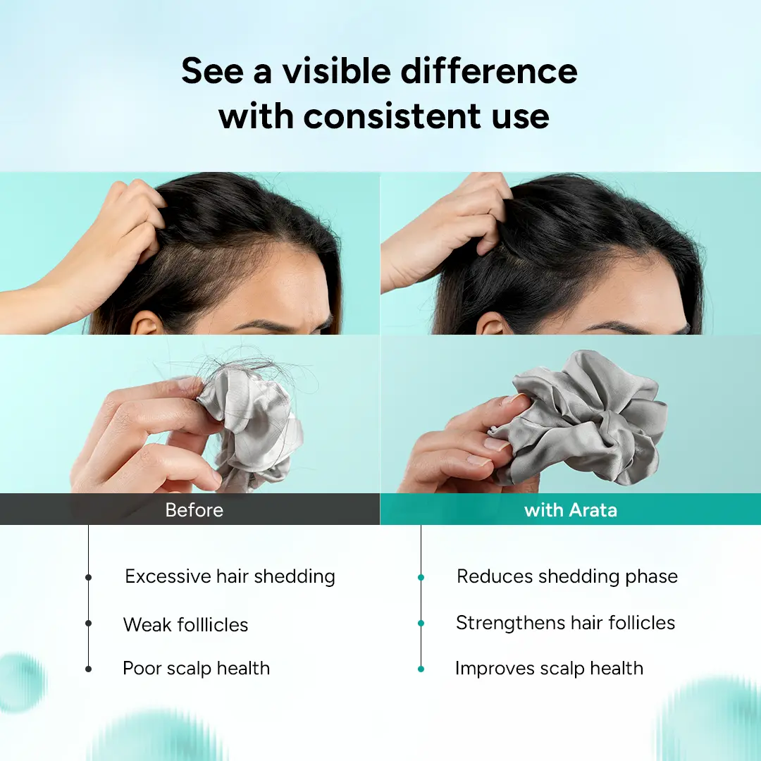 Anti Hair Fall Combo - Anti Hair Fall Shampoo 200ml + Serum 30ml - Free Derma Roller + Scalp Massager - Image 6