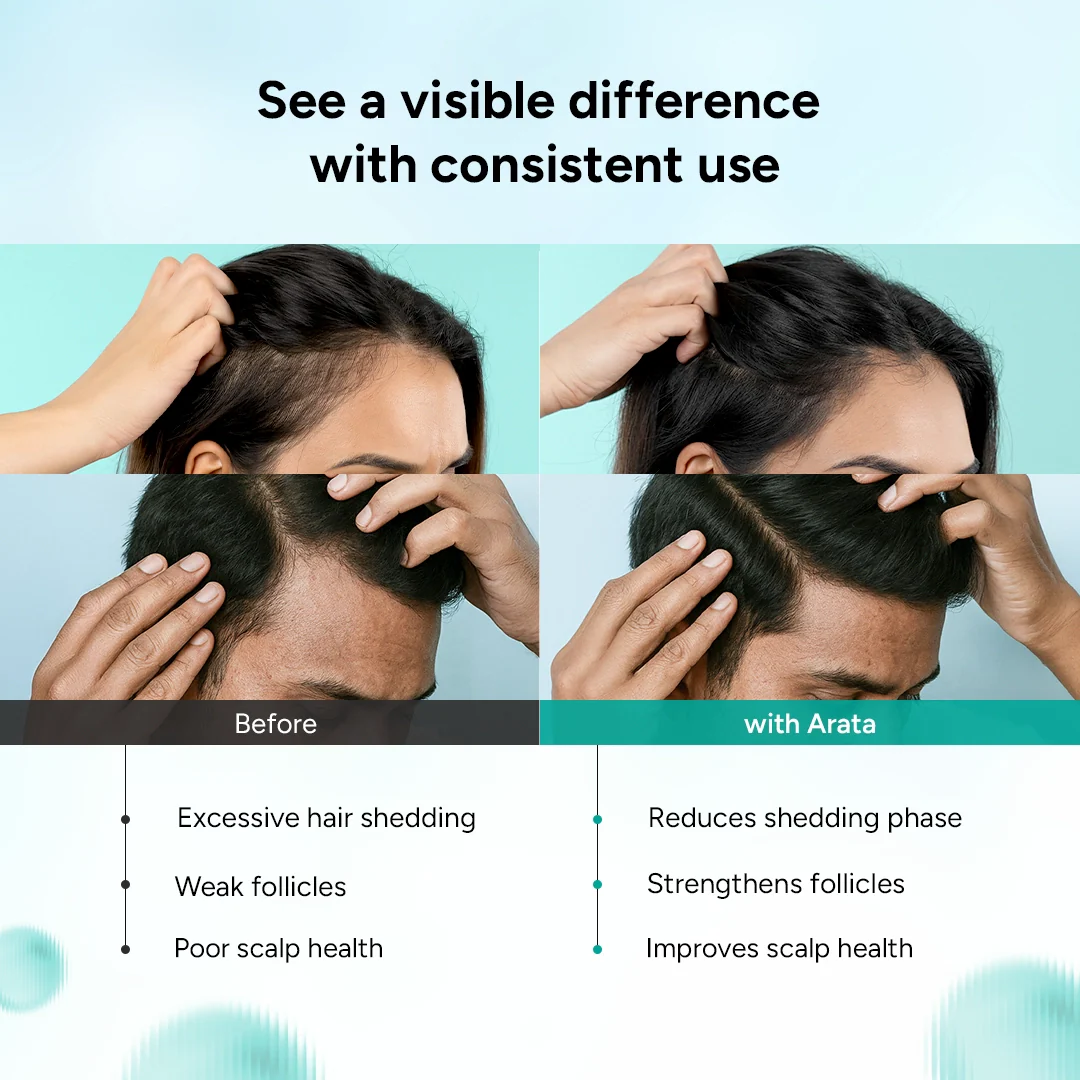 Multi-Active Anti-Hair Fall Shampoo for Hair Thinning & Hair Fall Reduction | Powered by Hairdian AP, Caffeine, Biotin, and Rosemary - Image 4