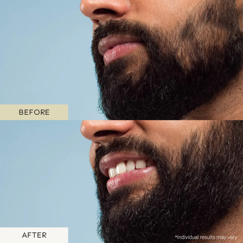 Beard Growth Oil - 30ml BYOB - Image 4