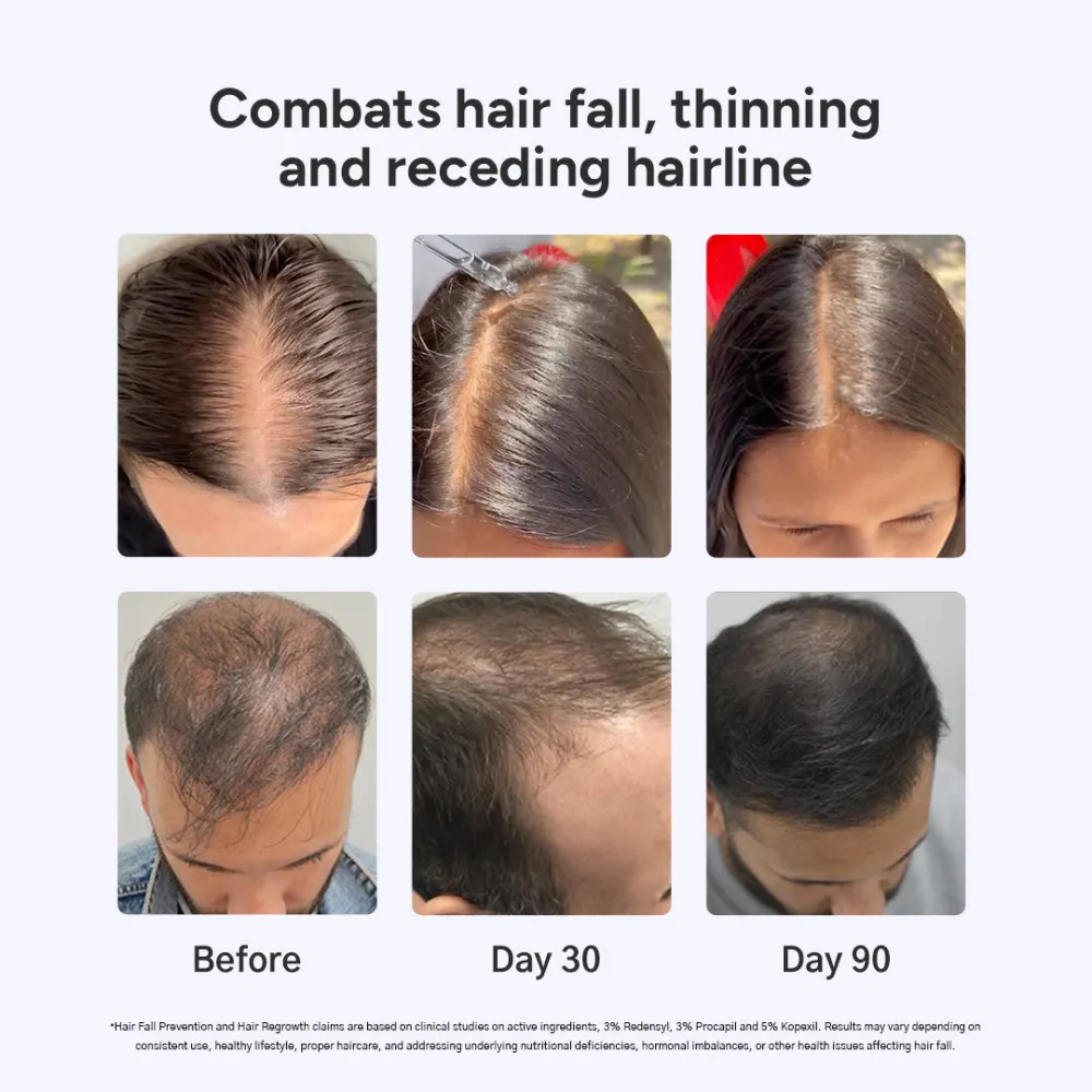 Arata Hair Growth Serum for Men and Women | For Fuller, Denser, Thicker Hair Growth BYOB - Image 4