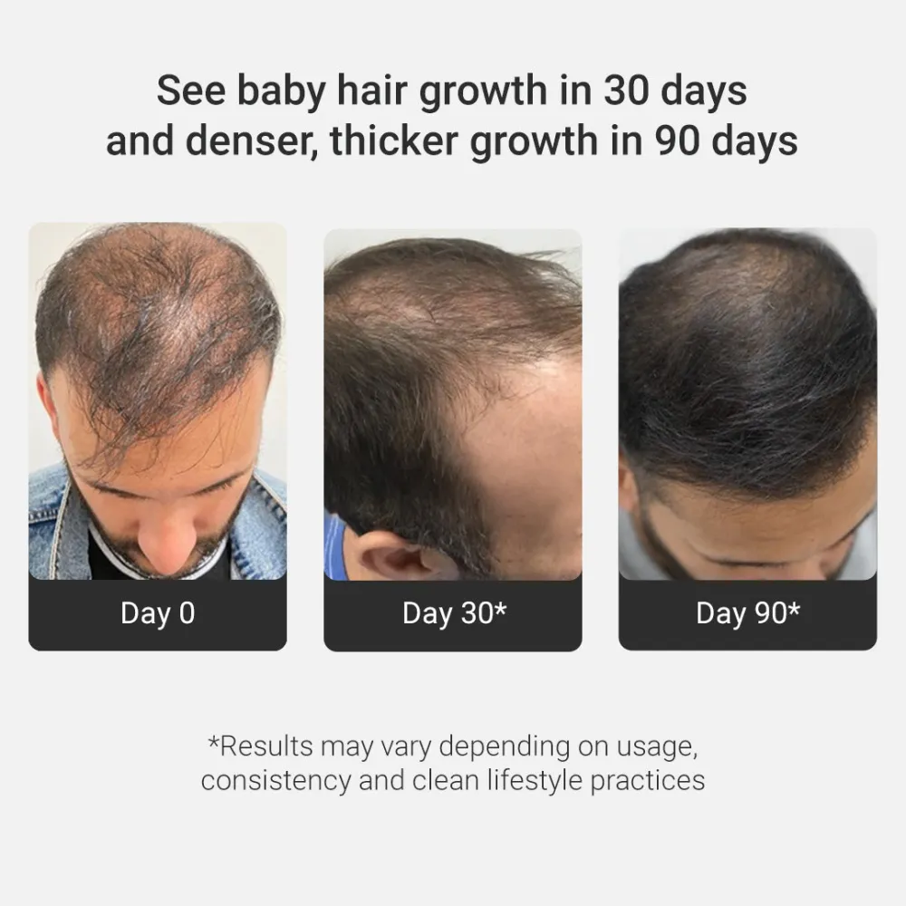 Grow Strong Combo - Super Shampoo 300ml + Serum 30ml - Image 3
