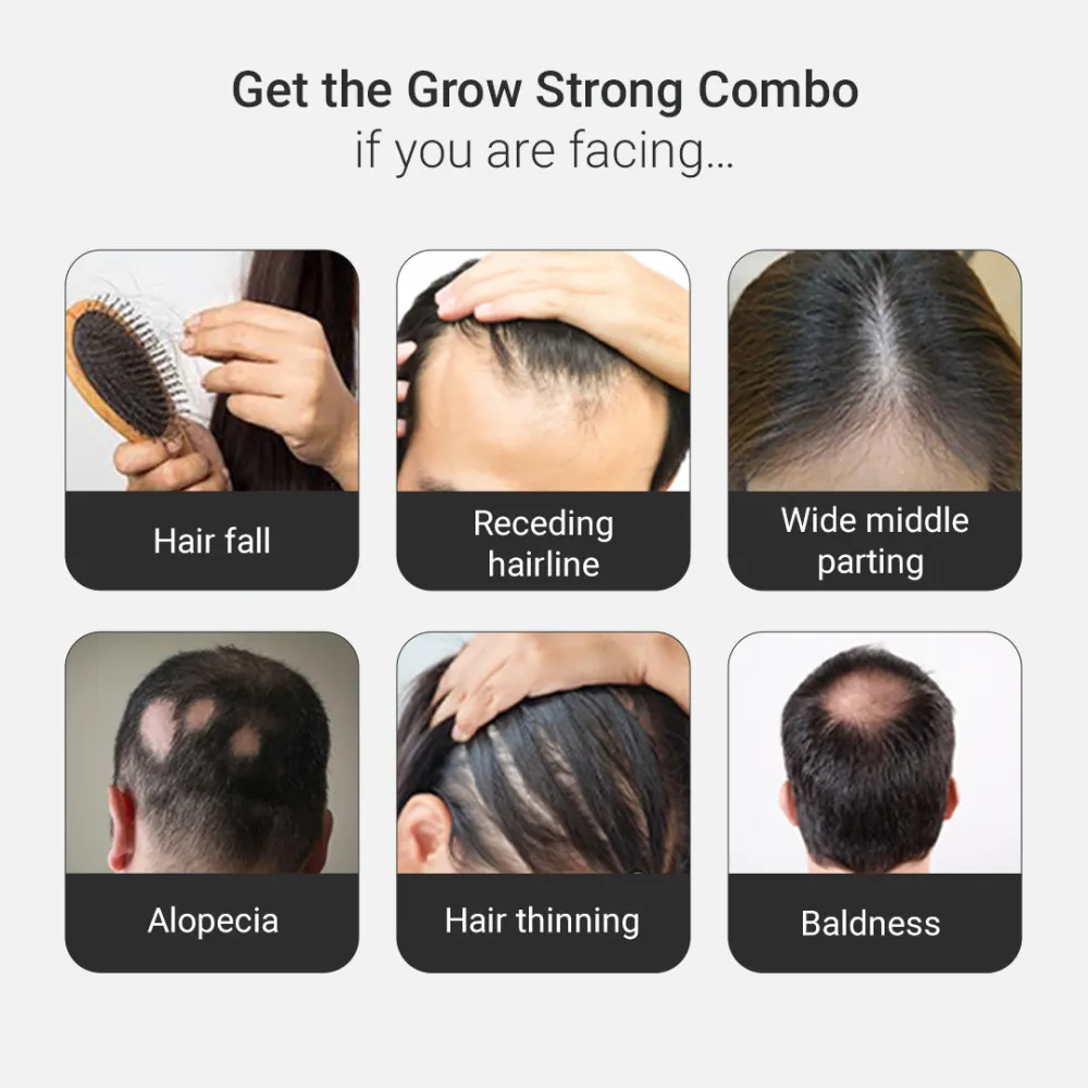 Grow Strong Combo - Super Shampoo 300ml + Serum 30ml - Free Derma Roller + Scalp Massager - Image 9