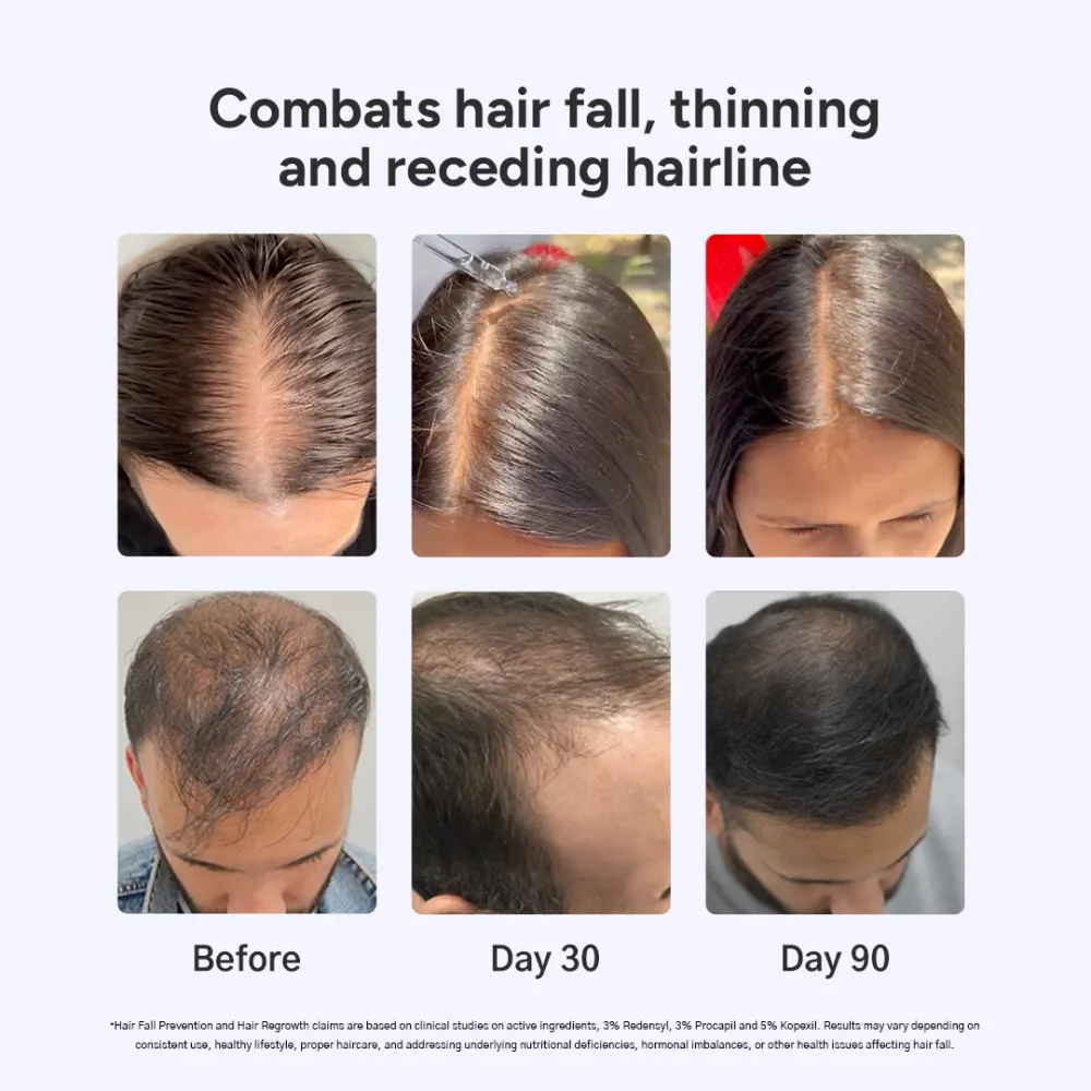 Arata Hair Growth Serum for Men and Women | For Fuller, Denser, Thicker Hair Growth - Image 3
