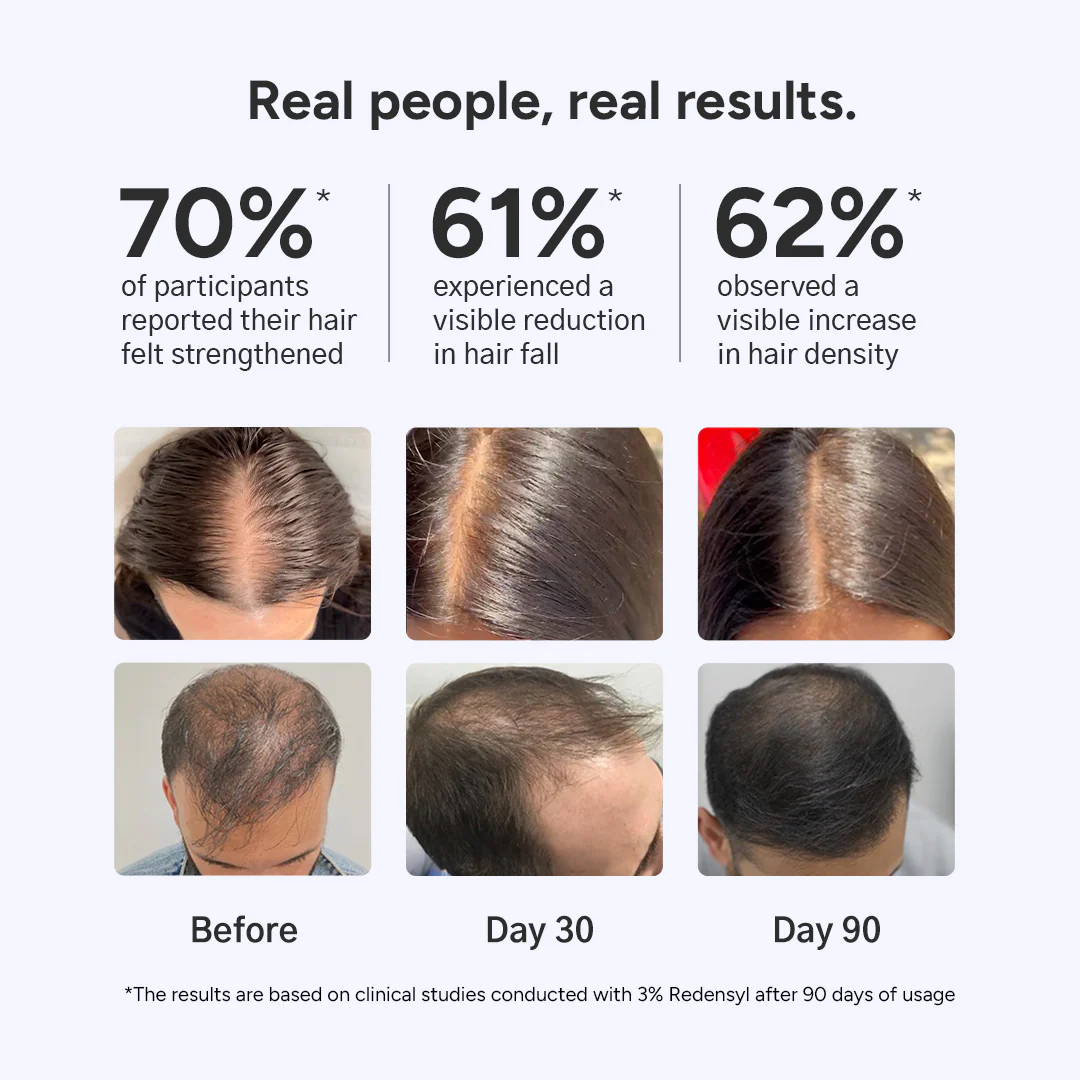 Arata Hair Growth Serum for Men and Women | For Fuller, Denser, Thicker Hair Growth | Free Derma Roller - Image 3