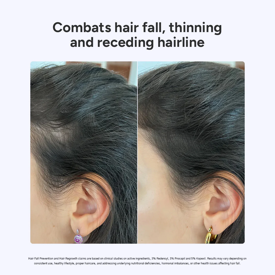 Arata Hair Growth Serum for Men and Women | For Fuller, Denser, Thicker Hair Growth | Free Derma Roller - Image 5