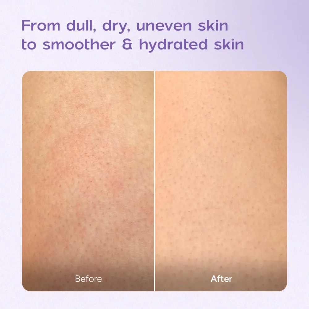 Niacinamide Body Milk for Dull and Dehydrated Skin | Lightweight and Fast-Absorbing | Provides Hydration | 200 ml - Image 7